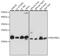NADH:Ubiquinone Oxidoreductase Subunit B11 antibody, A08638, Boster Biological Technology, Western Blot image 