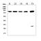 SMAD Specific E3 Ubiquitin Protein Ligase 2 antibody, RP1102, Boster Biological Technology, Western Blot image 