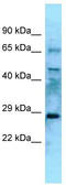 Eyes absent homolog 4 antibody, TA345588, Origene, Western Blot image 