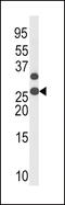 Cyclin Dependent Kinase Inhibitor 1B antibody, MBS9200928, MyBioSource, Western Blot image 
