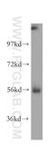 Mannosyl (Alpha-1,6-)-Glycoprotein Beta-1,2-N-Acetylglucosaminyltransferase antibody, 15772-1-AP, Proteintech Group, Western Blot image 