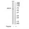 ATP Binding Cassette Subfamily D Member 4 antibody, TA312919, Origene, Western Blot image 