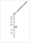 Erythropoietin antibody, LS-C167821, Lifespan Biosciences, Western Blot image 
