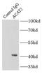 ACAT-2 antibody, FNab00073, FineTest, Immunoprecipitation image 