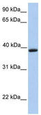 Aquaporin 10 antibody, TA342084, Origene, Western Blot image 