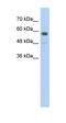 Transmembrane Protein 8B antibody, orb325017, Biorbyt, Western Blot image 