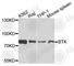 Bruton Tyrosine Kinase antibody, A0500, ABclonal Technology, Western Blot image 