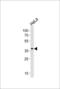 Sushi Repeat Containing Protein X-Linked antibody, LS-C161507, Lifespan Biosciences, Western Blot image 