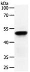 Acrosin antibody, orb107614, Biorbyt, Western Blot image 