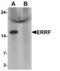 Steroid Receptor Associated And Regulated Protein antibody, LS-B10094, Lifespan Biosciences, Western Blot image 