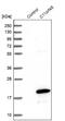 Chromosome 11 Open Reading Frame 45 antibody, NBP1-81900, Novus Biologicals, Western Blot image 