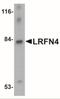 Leucine Rich Repeat And Fibronectin Type III Domain Containing 4 antibody, NBP2-41100, Novus Biologicals, Western Blot image 