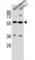 ATP Binding Cassette Subfamily G Member 4 antibody, abx026975, Abbexa, Western Blot image 