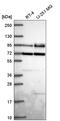 Segment polarity protein dishevelled homolog DVL-2 antibody, HPA064732, Atlas Antibodies, Western Blot image 