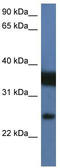 Zinc Finger Matrin-Type 2 antibody, TA343994, Origene, Western Blot image 