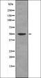 Mitogen-activated protein kinase 7 antibody, orb335814, Biorbyt, Western Blot image 