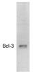 B-cell lymphoma 3 protein homolog antibody, GTX79353, GeneTex, Western Blot image 