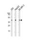 Sterol O-Acyltransferase 1 antibody, LS-C344358, Lifespan Biosciences, Western Blot image 