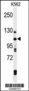 Telomere Maintenance 2 antibody, 61-673, ProSci, Western Blot image 