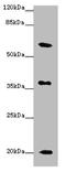 Xg Glycoprotein (Xg Blood Group) antibody, A63804-100, Epigentek, Western Blot image 