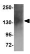 Zinc Finger Protein 536 antibody, GTX85225, GeneTex, Western Blot image 