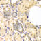 SMAD Family Member 1 antibody, A1101, ABclonal Technology, Immunohistochemistry paraffin image 