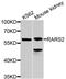 Arginyl-TRNA Synthetase 2, Mitochondrial antibody, PA5-76405, Invitrogen Antibodies, Western Blot image 