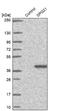 SPG21 Abhydrolase Domain Containing, Maspardin antibody, NBP1-89273, Novus Biologicals, Western Blot image 
