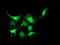 Phenylethanolamine N-methyltransferase antibody, LS-C172925, Lifespan Biosciences, Immunofluorescence image 