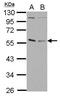 GA Binding Protein Transcription Factor Subunit Alpha antibody, GTX102830, GeneTex, Western Blot image 