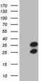 Ribosomal Protein L10a antibody, TA809519S, Origene, Western Blot image 