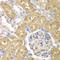 Aldo-Keto Reductase Family 1 Member A1 antibody, LS-C331236, Lifespan Biosciences, Immunohistochemistry paraffin image 