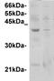 Glucose-dependent insulinotropic receptor antibody, TA354528, Origene, Western Blot image 