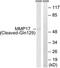 Matrix Metallopeptidase 17 antibody, LS-C121090, Lifespan Biosciences, Western Blot image 