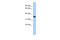 MAX Interactor 1, Dimerization Protein antibody, 31-254, ProSci, Western Blot image 