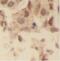 Ubiquitin carboxyl-terminal hydrolase 28 antibody, FNab09322, FineTest, Immunohistochemistry frozen image 