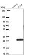 Intraflagellar Transport 22 antibody, PA5-60163, Invitrogen Antibodies, Western Blot image 