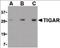 TP53 Induced Glycolysis Regulatory Phosphatase antibody, orb86697, Biorbyt, Western Blot image 