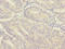 MORN Repeat Containing 5 antibody, A65358-100, Epigentek, Immunohistochemistry paraffin image 