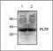 Phospholipid Transfer Protein antibody, orb88190, Biorbyt, Western Blot image 