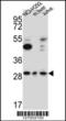 TATA-Box Binding Protein Associated Factor, RNA Polymerase I Subunit D antibody, 61-984, ProSci, Western Blot image 