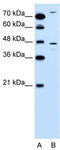 C-C Motif Chemokine Receptor 9 antibody, TA329181, Origene, Western Blot image 