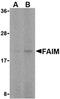 Fas apoptotic inhibitory molecule 1 antibody, orb74421, Biorbyt, Western Blot image 