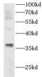 Aldo-Keto Reductase Family 1 Member E2 antibody, FNab00264, FineTest, Western Blot image 