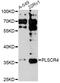 Phospholipid Scramblase 4 antibody, LS-C749660, Lifespan Biosciences, Western Blot image 