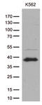 Integral Membrane Protein 2A antibody, M10051, Boster Biological Technology, Western Blot image 
