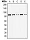 Junction Plakoglobin antibody, LS-C352407, Lifespan Biosciences, Western Blot image 