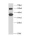 rRNA 2 -O-methyltransferase fibrillarin antibody, FNab03027, FineTest, Western Blot image 
