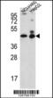 Actin Like 6B antibody, 61-883, ProSci, Western Blot image 