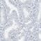 RCAN Family Member 3 antibody, HPA034533, Atlas Antibodies, Immunohistochemistry frozen image 